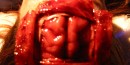 Additional assistance from Steven Dawley Brain Surgery